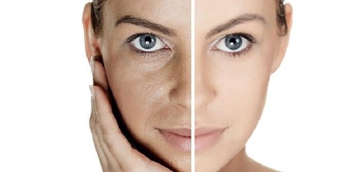 az arcbőr fiatalítása előtt és után