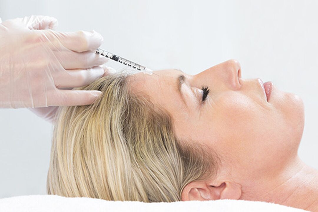 A plazmolifting az arcbőrfiatalítás injekciós módszere